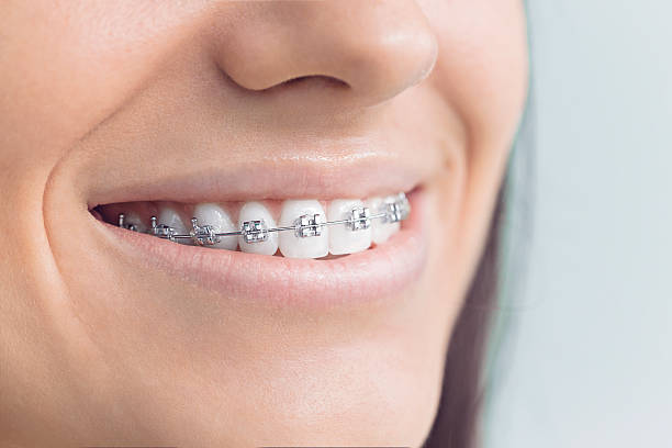 Dental Inlays and Onlays in Solomon, KS